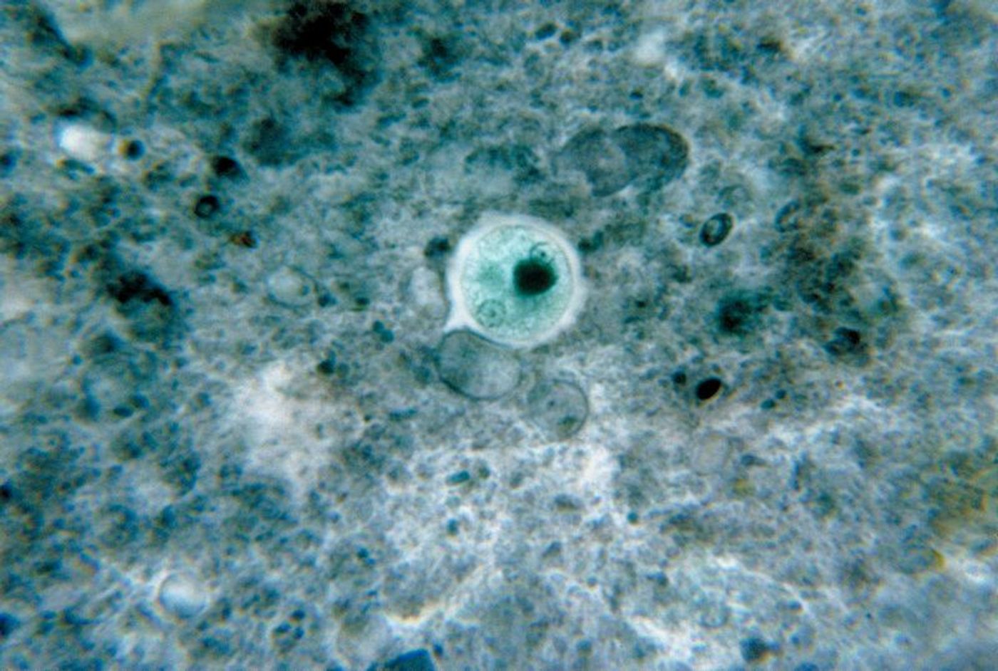 An Entamoeba histolytica cyst in a micrograph stained with chlorazol black. Credit: CDC/ Dr. George Healy