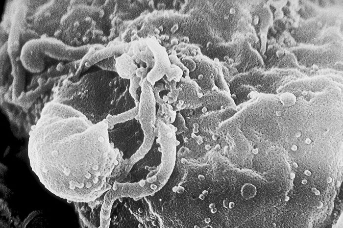 Scanning electron micrograph of HIV-1 budding from cultured lymphocyte. Multiple round bumps on cell surface represent sites of assembly and budding of virions. Credit: CDC Public Health Image Library