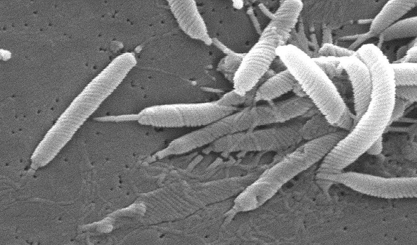 Scanning electron micrograph of Helicobacter bacteria. Credit: CDC