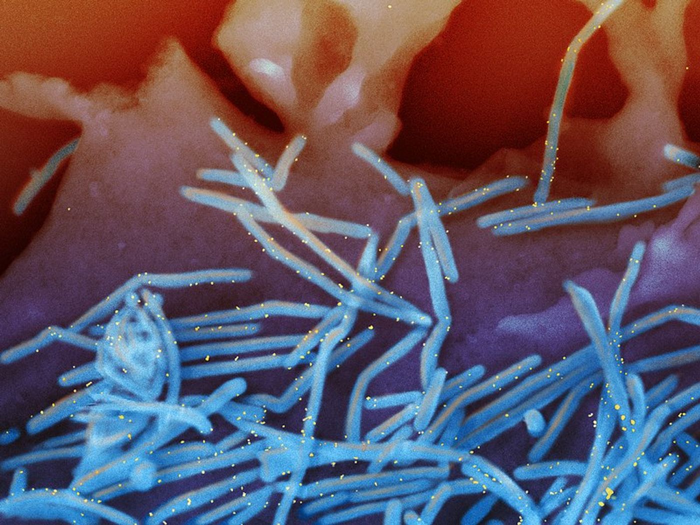 Scanning electron micrograph of human respiratory syncytial virus (RSV) virions (colorized blue). Credit: NIAID