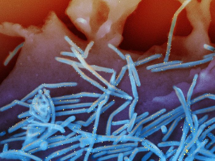 Scanning electron micrograph of human respiratory syncytial virus (RSV) virions (colorized blue). Credit: NIAID