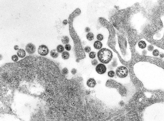 A transmission electron micrograph (TEM) of a number of Lassa virus virions adjacent to some cell debris. Source: CDC's Public Health Image Library