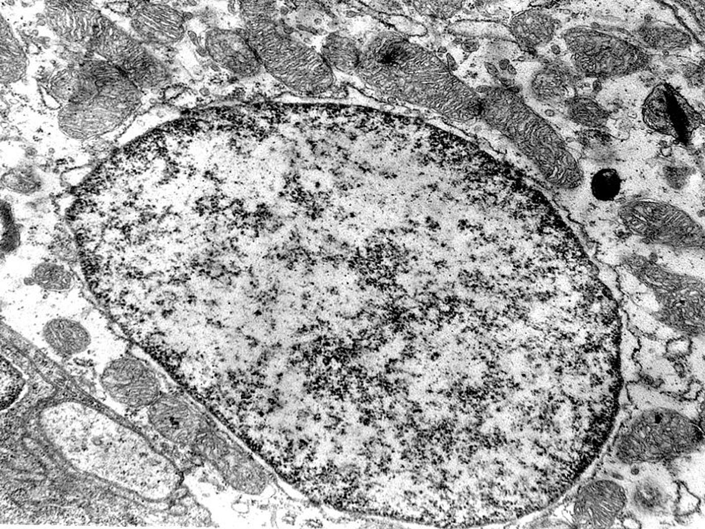 An electron micrograph image of a cell with several mitochondria surrounding the nucleus. Credit: Wikimedia User T. Voekler