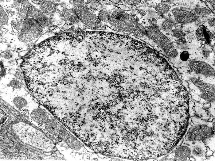 An electron micrograph image of a cell with several mitochondria surrounding the nucleus. Credit: Wikimedia User T. Voekler