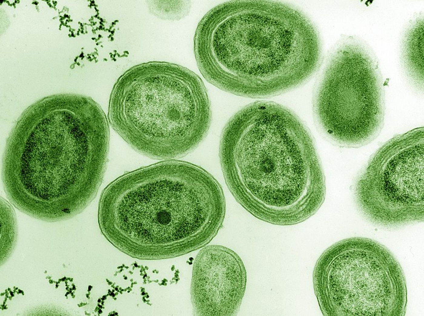 A TEM image of Prochlorococcus marinus - a globally important marine cyanobacterium./ Public domain image courtesy of Luke Thompson from Chisholm Lab and Nikki Watson from Whitehead, MIT