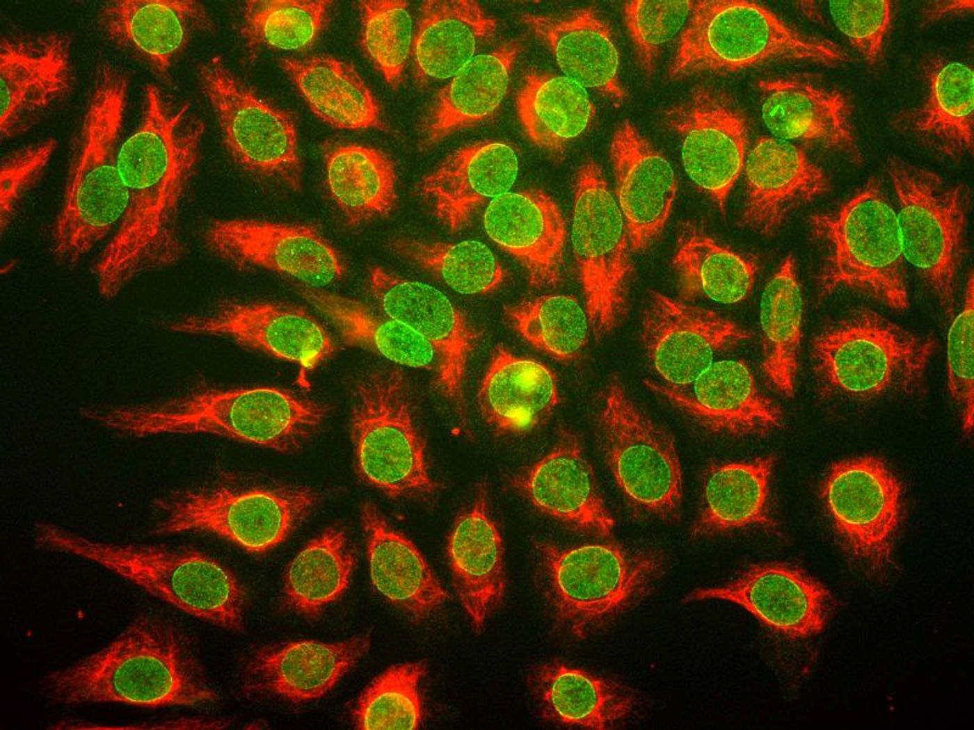 HeLa cells grown in tissue culture and stained in green for a protein of the nuclear pore complex. Credit: Gerry Shaw