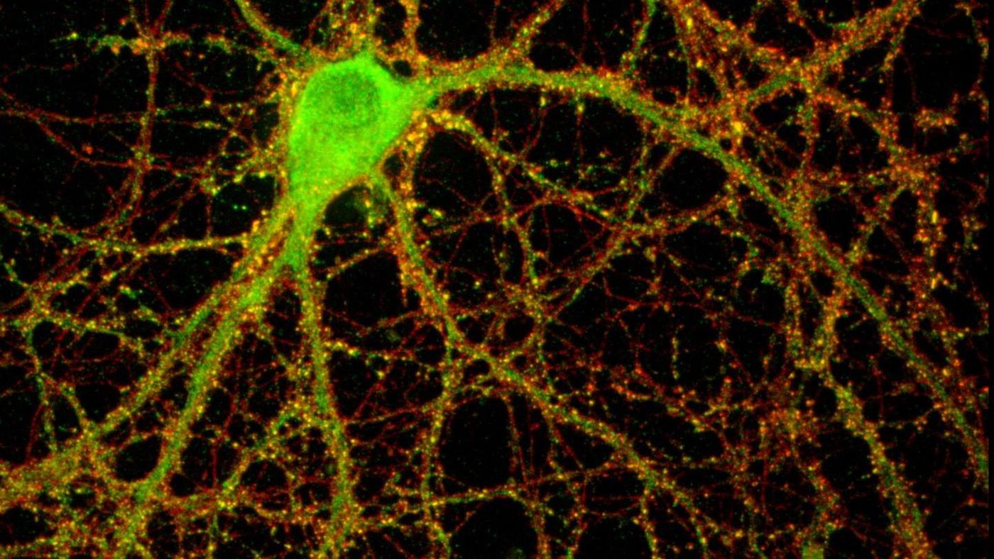 A mouse hippocampal neuron studded with thousands of synaptic connections (yellow).  / Credit: Image by Lisa Boulanger / Princeton University