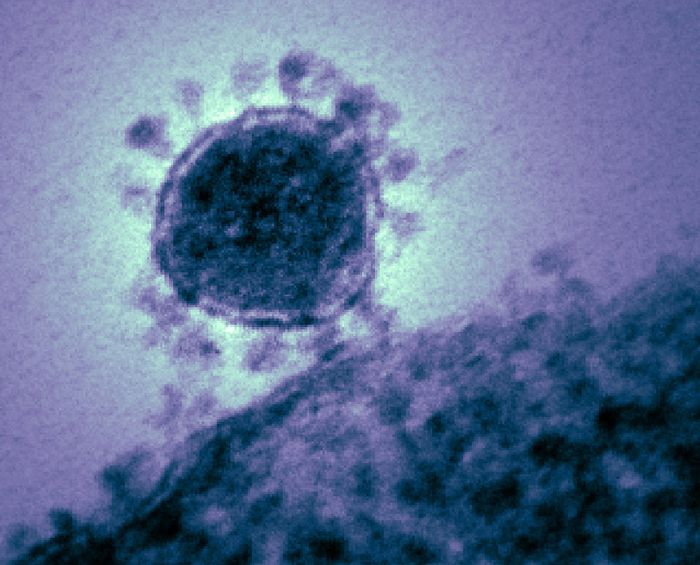 MERS-CoV  Colorized transmission electron micrograph of the Middle East respiratory syndrome coronavirus. Credit: NIAID