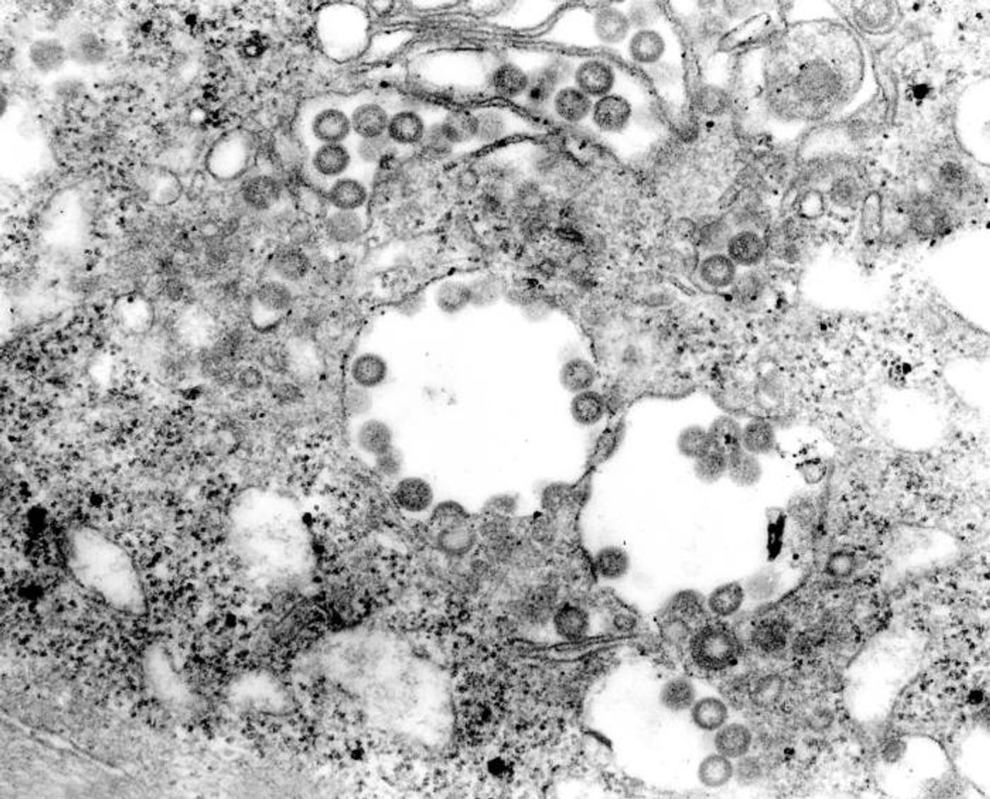 A TEM image of a highly magnified view of tissue infected with Rift Valley fever (RVF) virus. RVF virus is a member of the genus, Phlebovirus, in the family, Bunyaviridae. Numerous, spherical-shaped RVF virus particles are seen throughout the infected cells./ Credit: CDC/ F. A. Murphy; J. Dalrymple