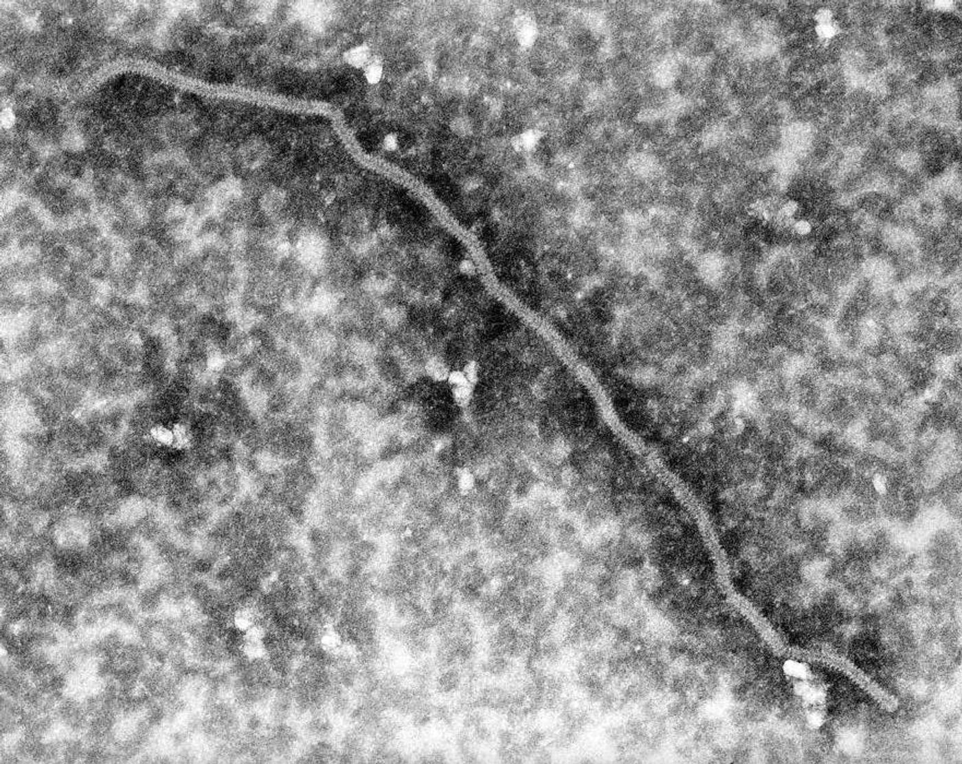 Under a highly magnified view of 168,000x, this 1999 transmission electron micrographic shows a Nipah virus nucleocapsid / Credit: CDC/ C. S. Goldsmith; P. Rota