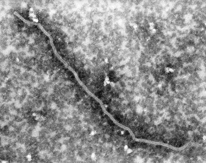 TEM image of a Nipah virus. Note the distinctive herringbone-like structure, which is characteristic of paramyxovirus nucleocapsids. / Credit: CDC/ C. S. Goldsmith; P. Rota