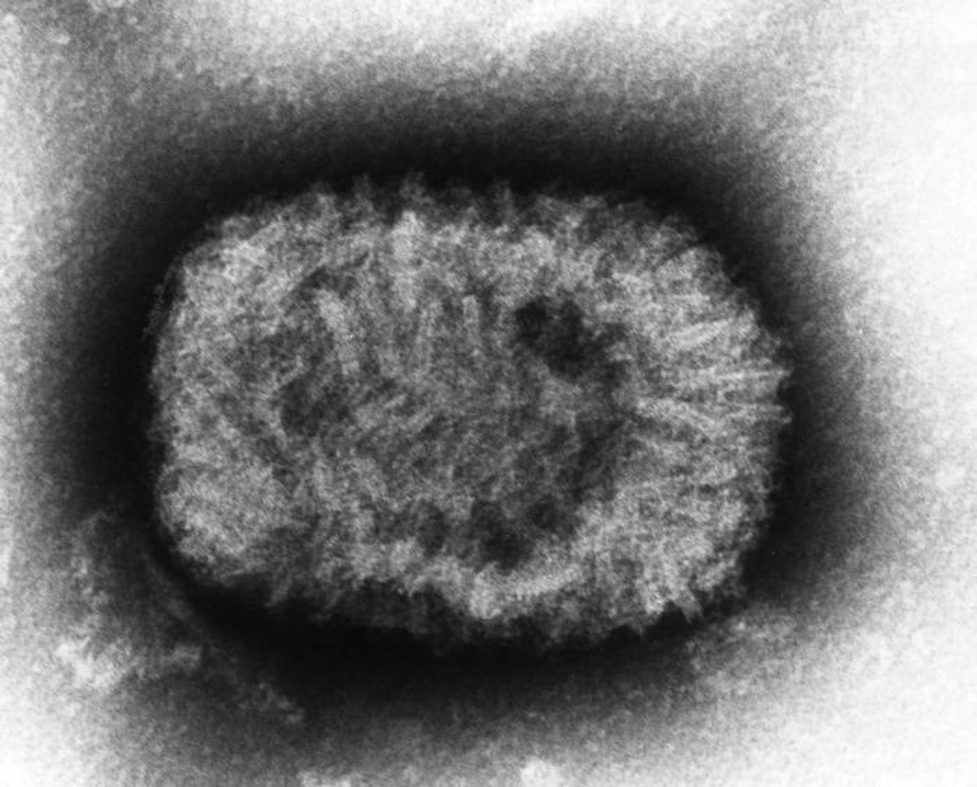 Highly magnified at 310,000X, this negative-stained transmission electron microscopic (TEM) image depicted a smallpox (variola) virus particle, or a single virion. / Credit: CDC / James Nakano