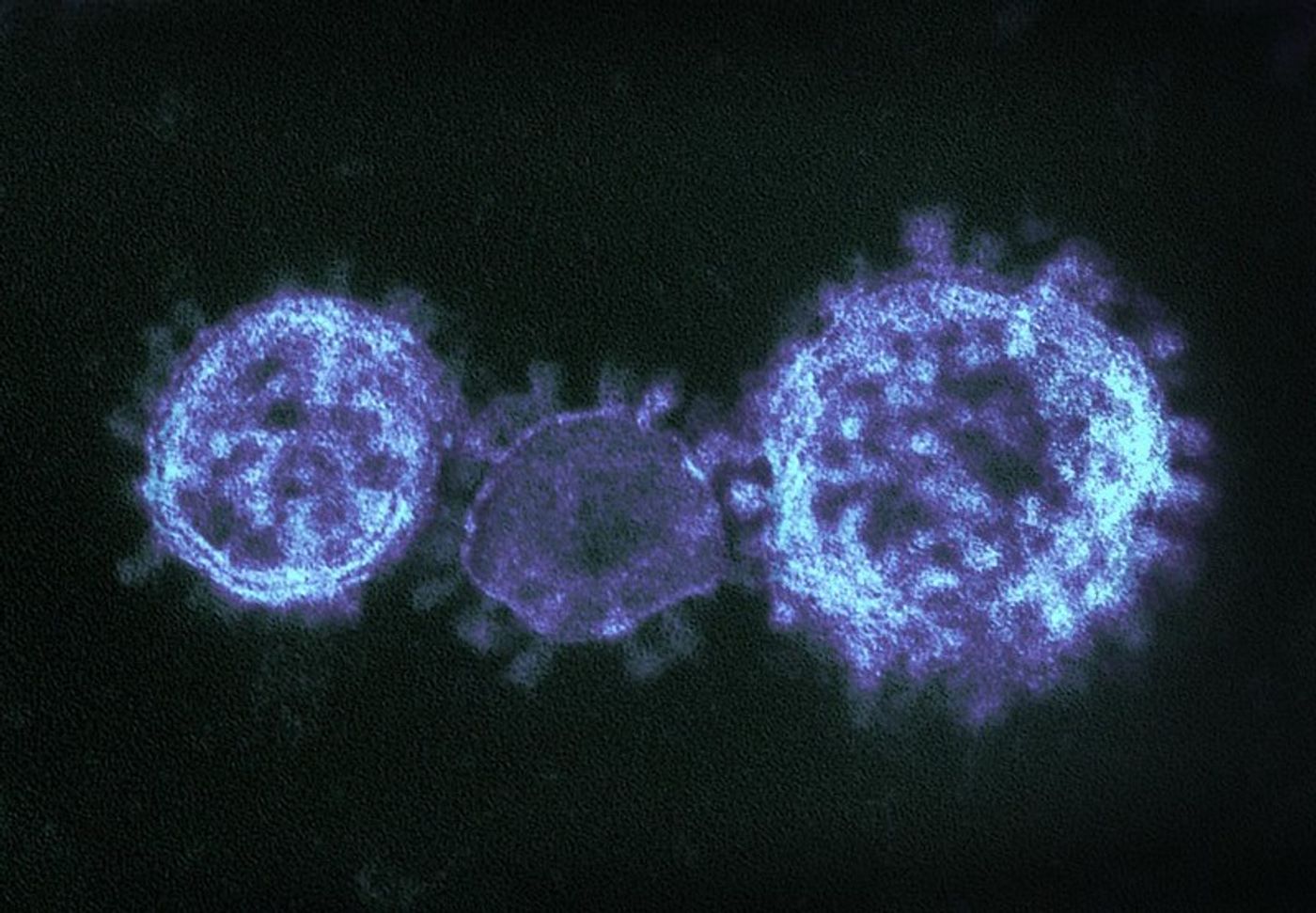 Colorized transmission electron micrograph showing particles of the Middle East respiratory syndrome coronavirus that emerged in 2012. / Credit: NIAID