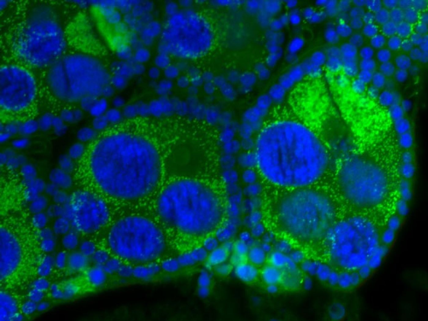 Wolbachia (green) in insect cells.