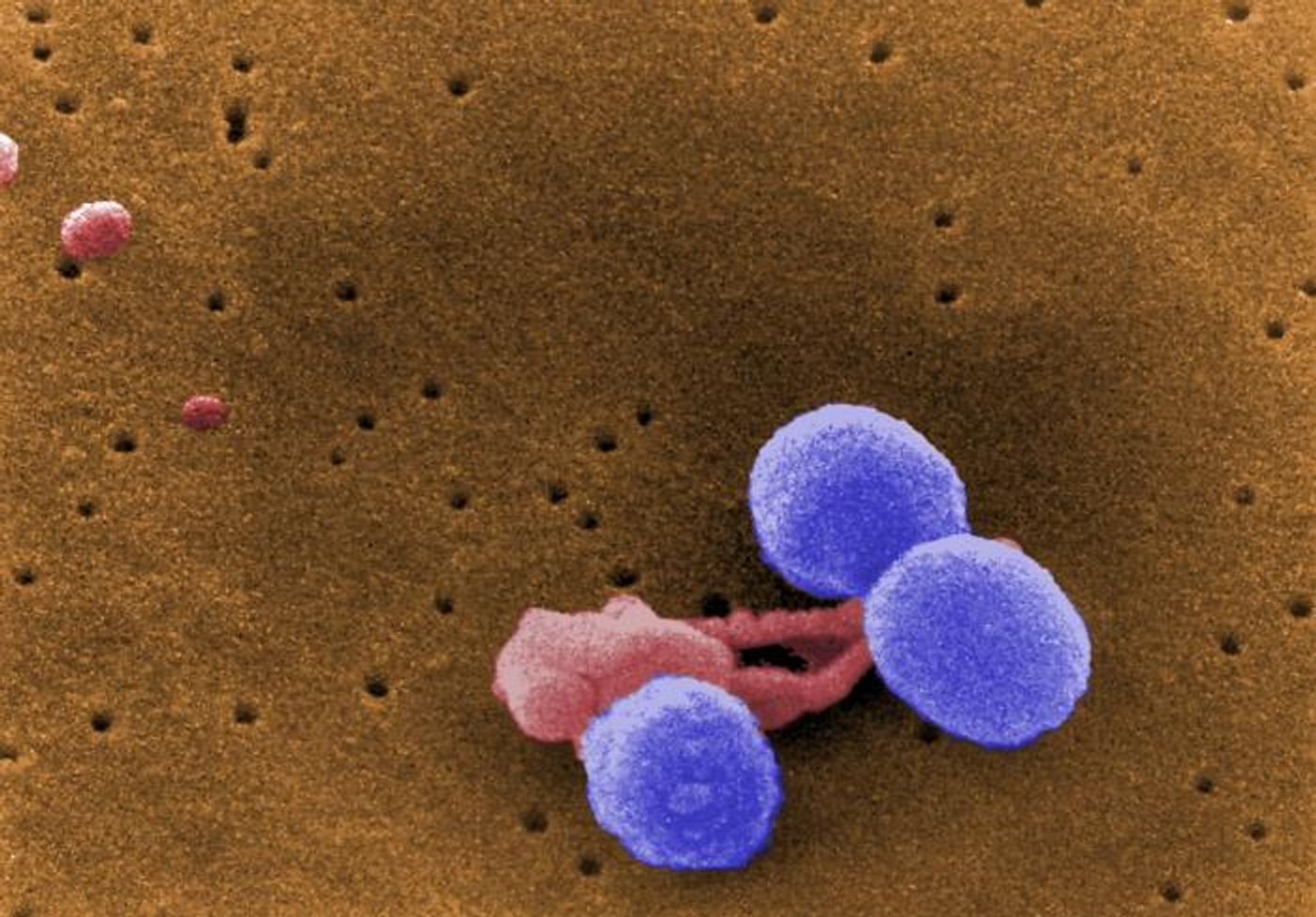 A digitally-colorized, scanning electron microscopic (SEM) image depicting what were three Streptococcus pneumoniae bacteria (lavender), as they were attacked by an irregularly-shaped white blood cell (pink) / Credit: CDC/ Dr. Richard Facklam/Janice Haney Carr
