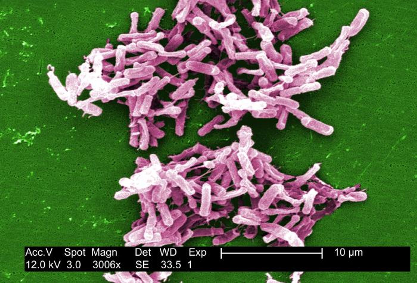 A digitally-colorized scanning electron microscopic image depicting a group of Clostridium difficile bacteria, cultured from a stool sample after an outbreak. / Credit: CDC/ Lois S. Wiggs