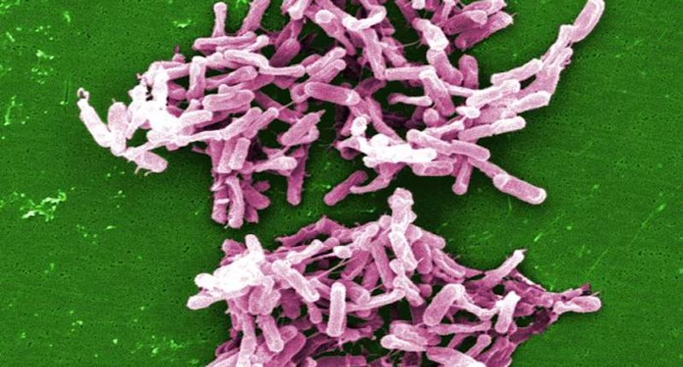 A SEM image of Clostridium difficile bacteria. / Image credit: CDC/ Lois S. Wiggs / Photo Credit: Janice Carr