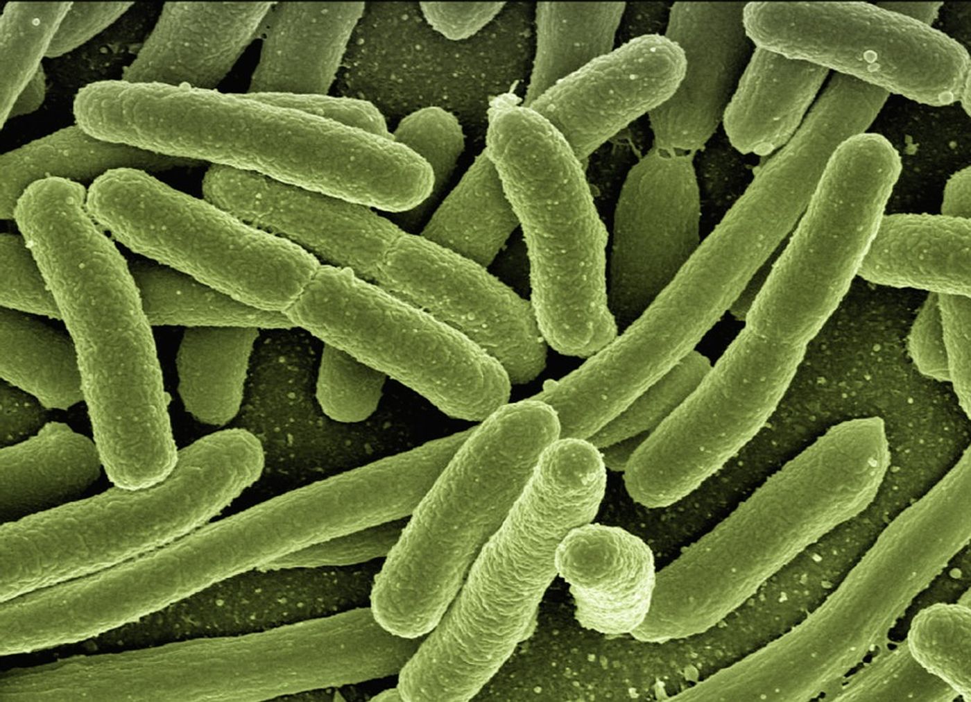 Could bacteria be to blame for many chronic illnesses? / Credit: Max Pixel