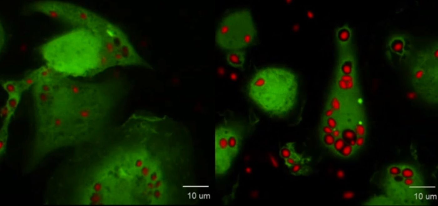 Living macrophages releasing IL-1. The bright green spots are large protein complexes that stimulate gasdermin D to form pores allowing IL-1 to pass through. Credit: Charles Evavold, Boston Children's Hospital