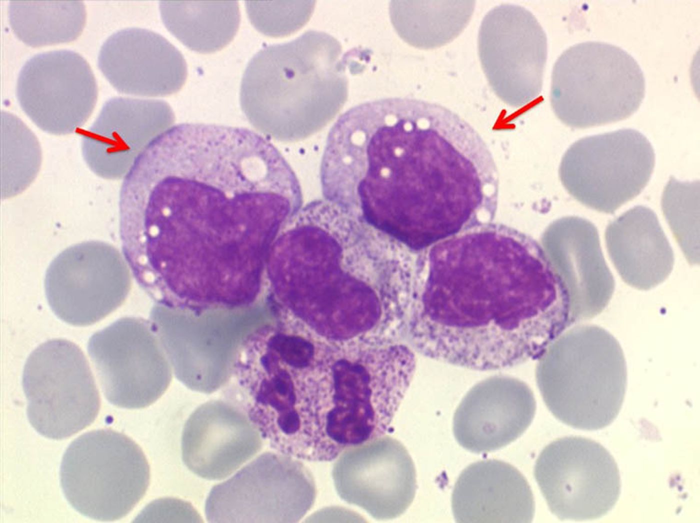 Monocytes