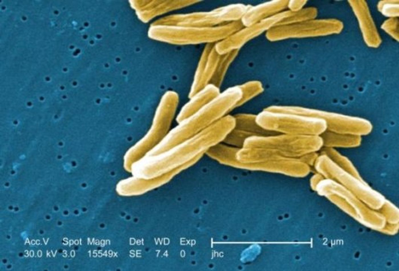 Under a magnification of 15549x, this colorized scanning electron micrograph (SEM) shows a number of Mycobacterium tuberculosis bacteria. / Credit: CDC/Janice Carr