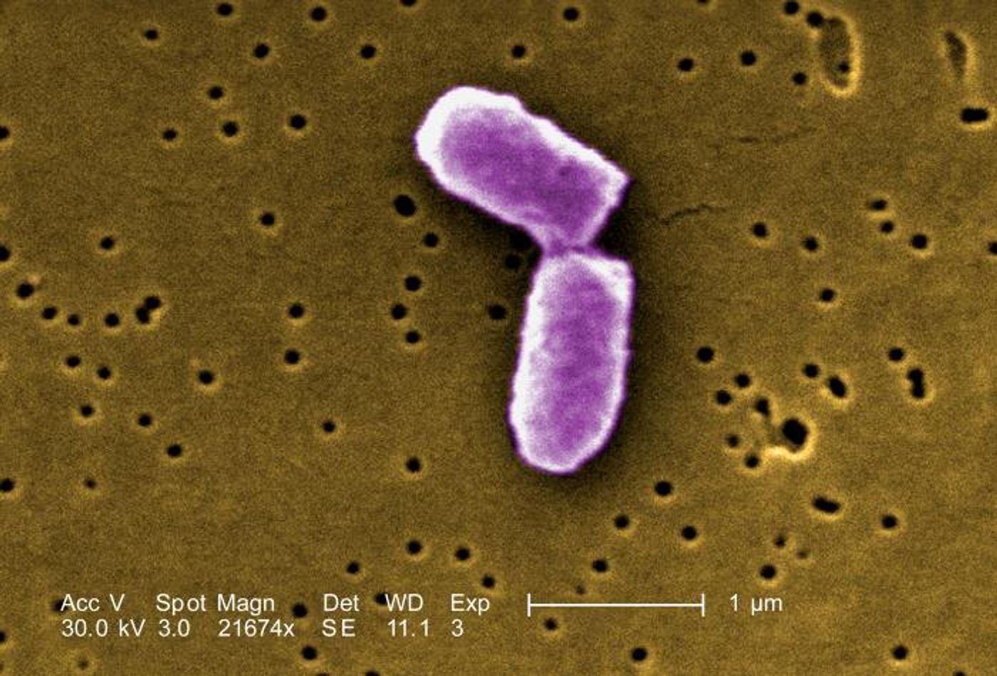 Caption: A digitally-colorized, scanning electron microscopic (SEM) image depicts a dividing, Escherichia coli bacterium at 21674X / Credit: CDC/ Evangeline Sowers, Janice Haney Carr