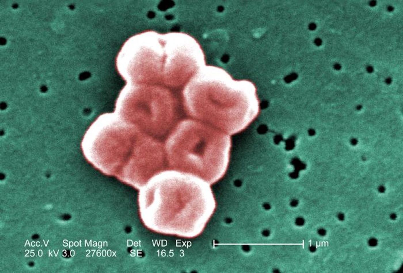 A digitally colorized SEM image of Gram-negative, non-motile, Acinetobacter baumannii bacteria, at a magnification of 27600X. / Credit: CDC/ Matthew J. Arduino / Photo Credit: Janice Haney Carr