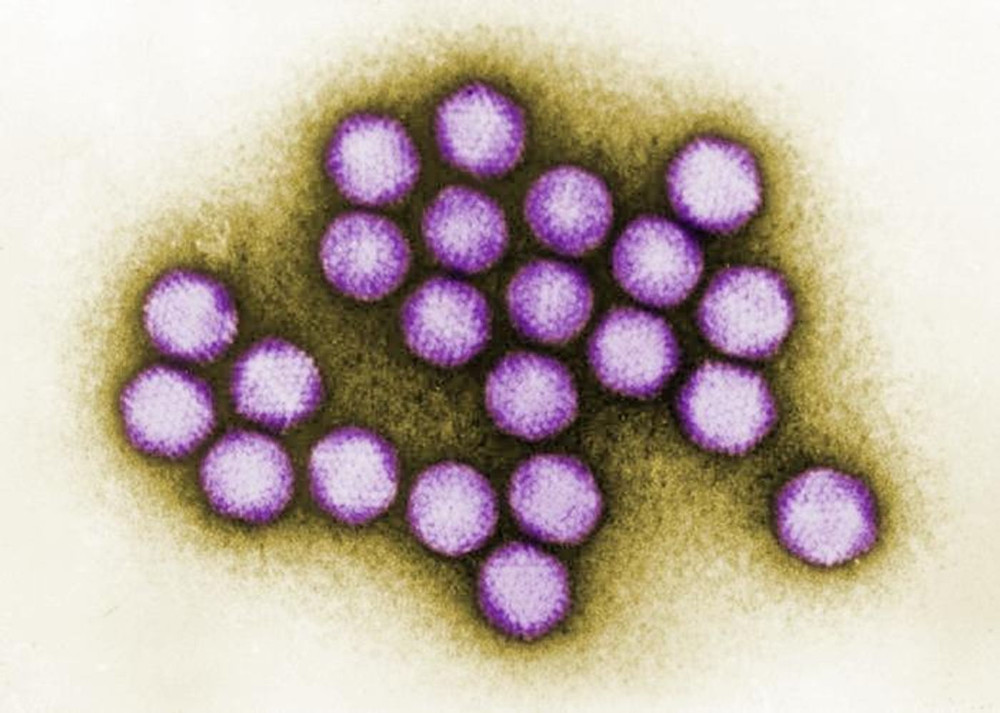 A digitally-colorized TEM image of a small cluster of adenovirus virions. / Credit: CDC/ Dr. G. William Gary, Jr.
