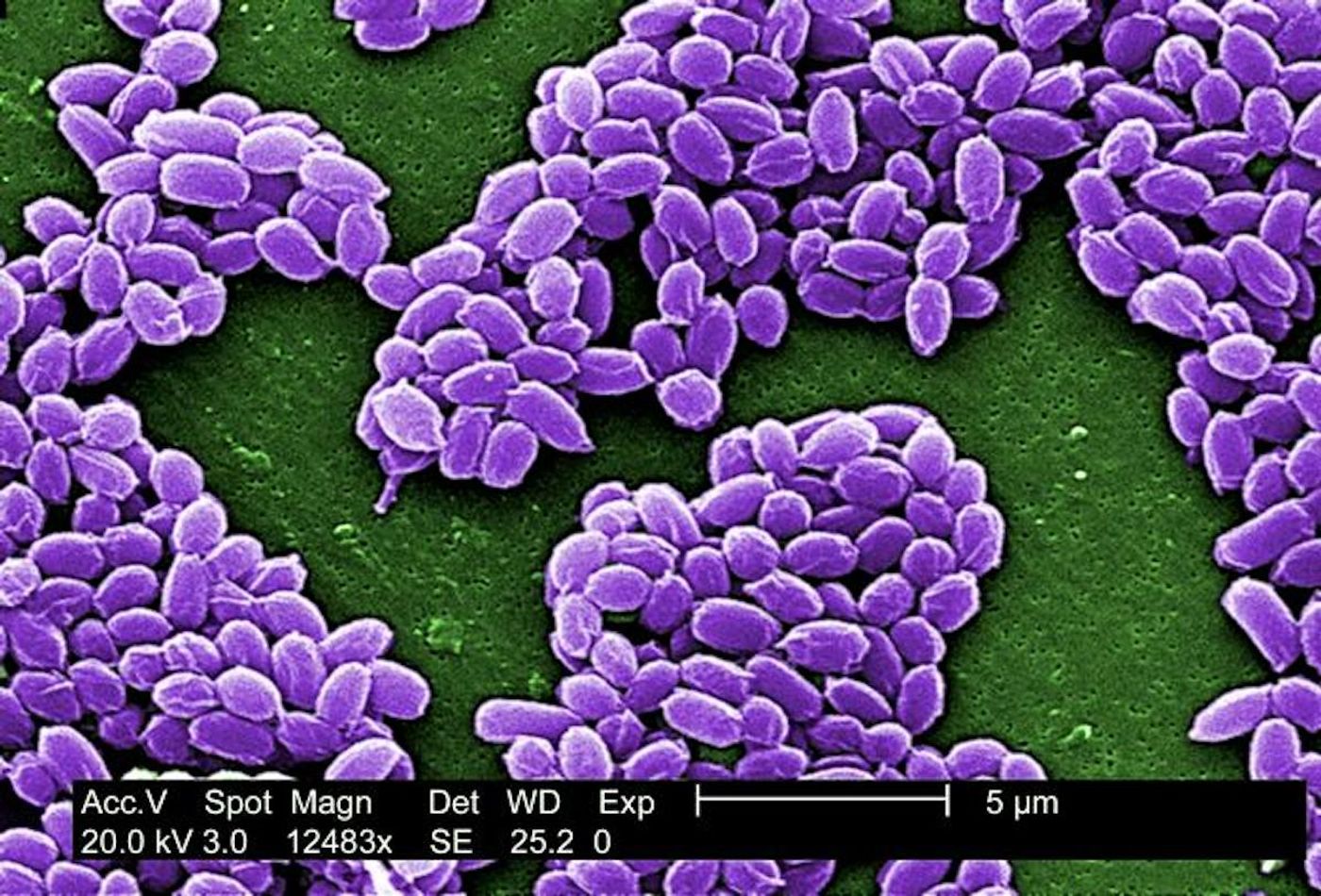 A 12,483X, digitally-colorized, SEM image of spores from the Sterne strain of Bacillus anthracis bacteria.  / Credit: CDC/ Laura Rose / Photo Credit: Janice Haney Carr