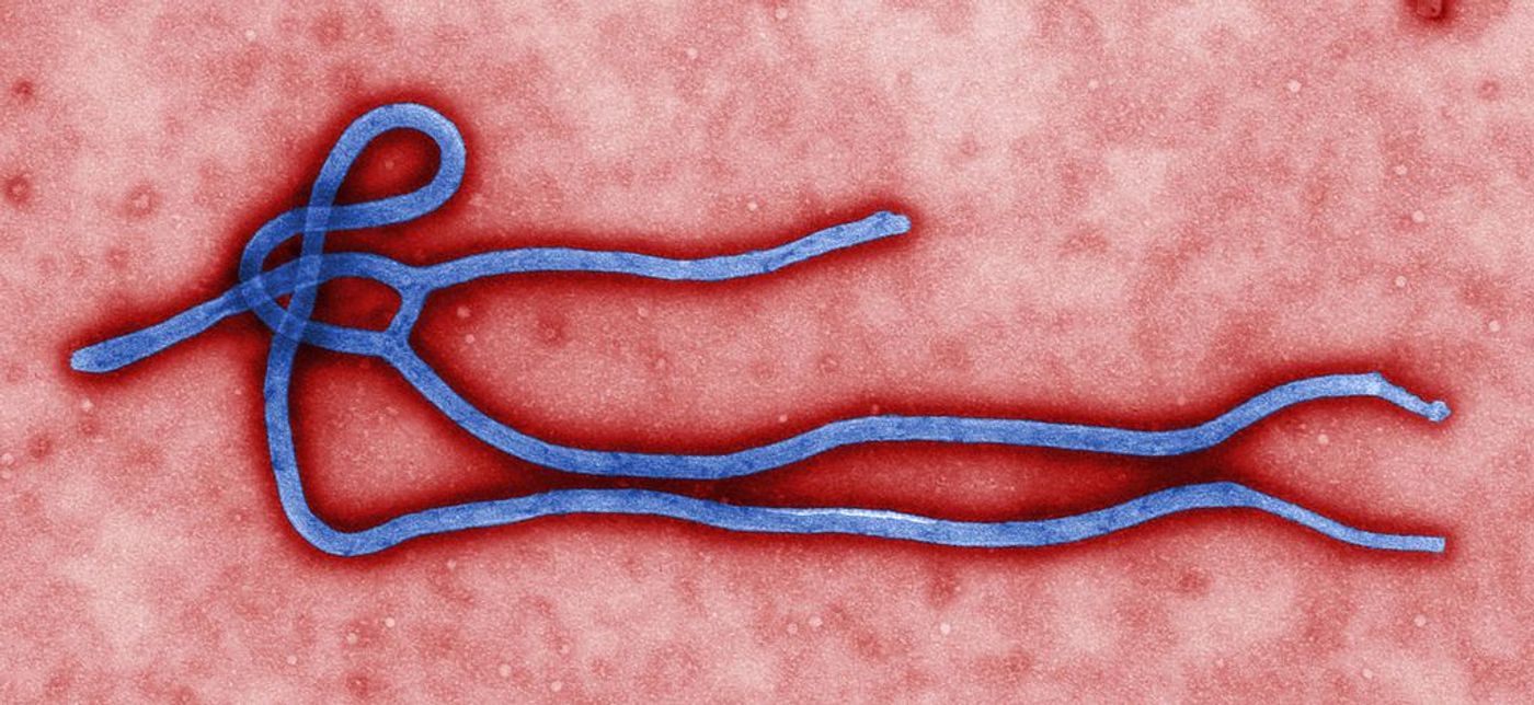Colorized transmission electron micrograph of Ebola virus. Credit: CDC, Cynthia Goldsmith  