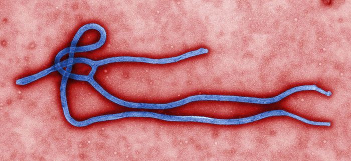 Colorized transmission electron micrograph of Ebola virus. Credit: CDC, Cynthia Goldsmith  