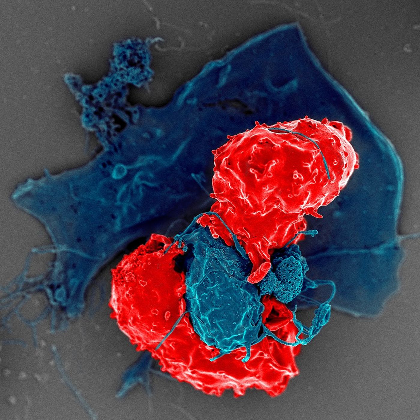regulatory T cell