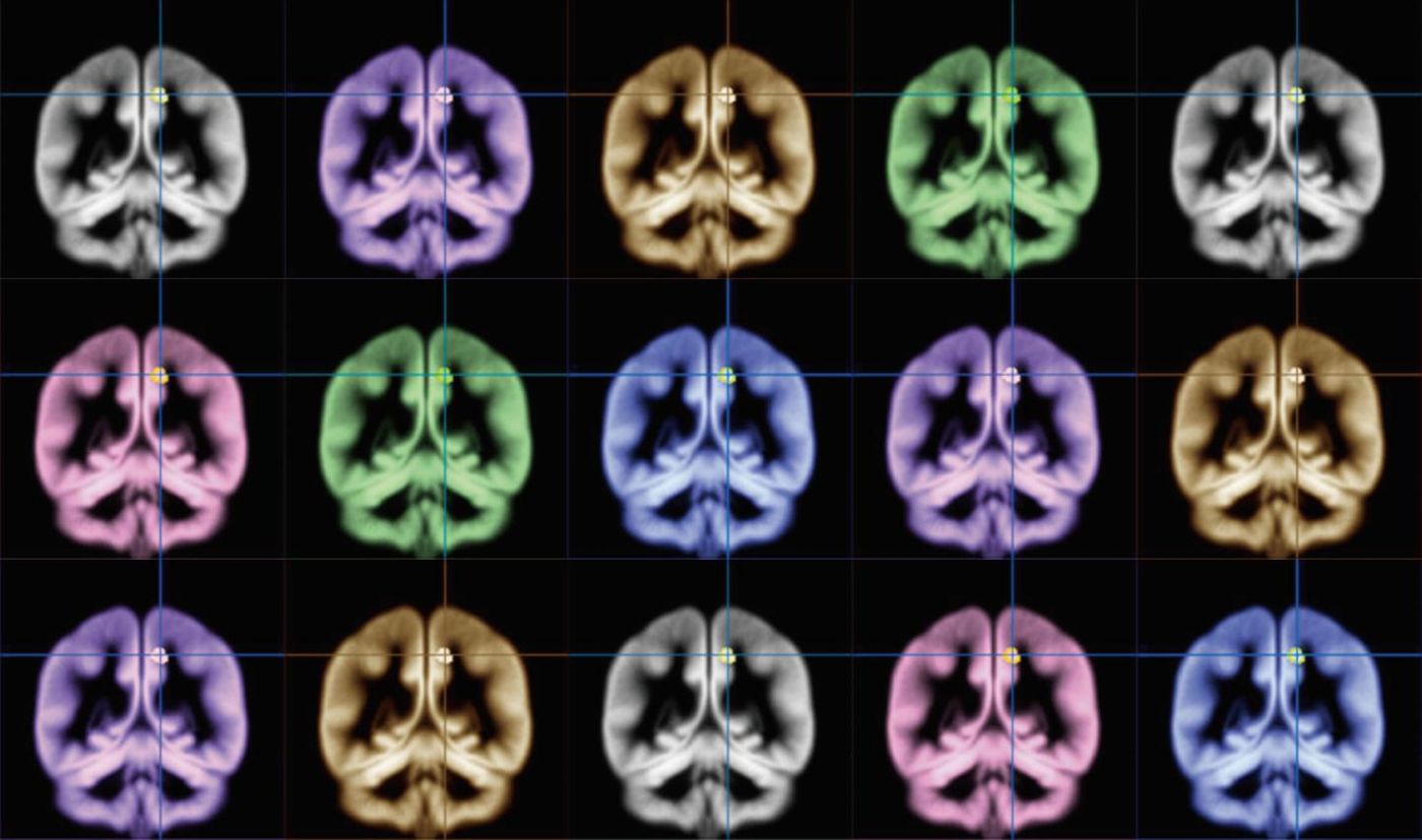 Kyoto University scientists have used MRI brain scans to find the location of happiness.