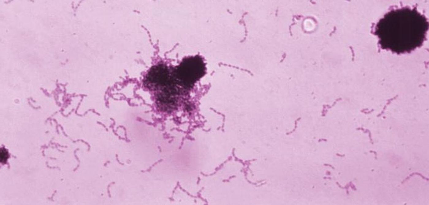 Streptococcus mutans bacteria. / Credit: CDC/ Dr. Richard Facklam