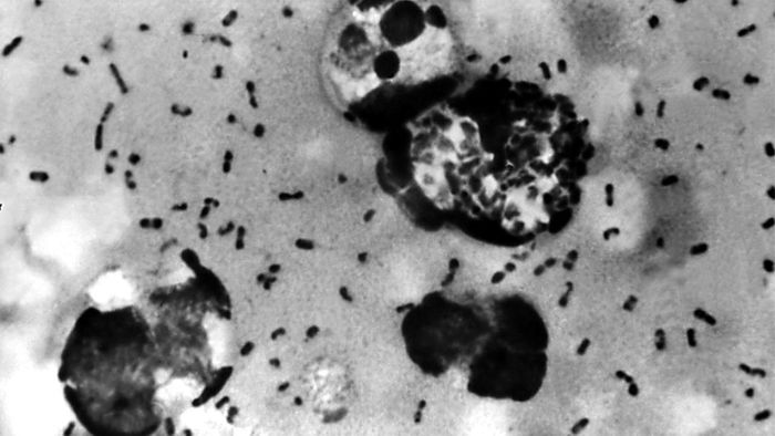 Yersinia pestis bacteria | Credit: abc13.com
