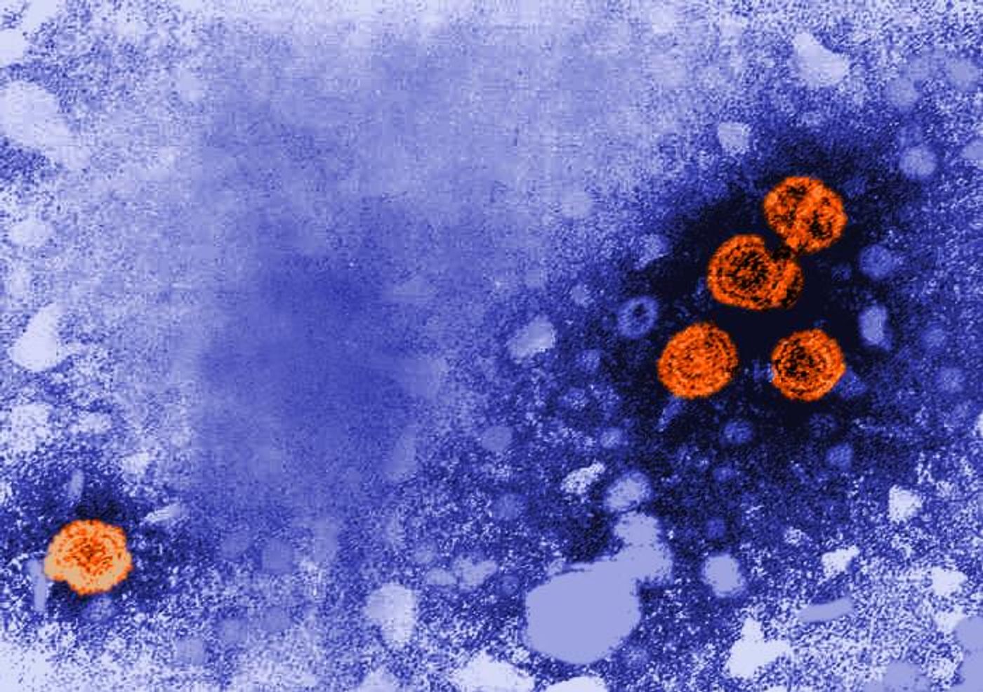 This TEM image revealed the presence of hepatitis B virus (HBV) particles (orange). The round virions, which measure 42nm in diameter, are known as Dane particles. / Credits: CDC/ Dr. Erskine Palmer
