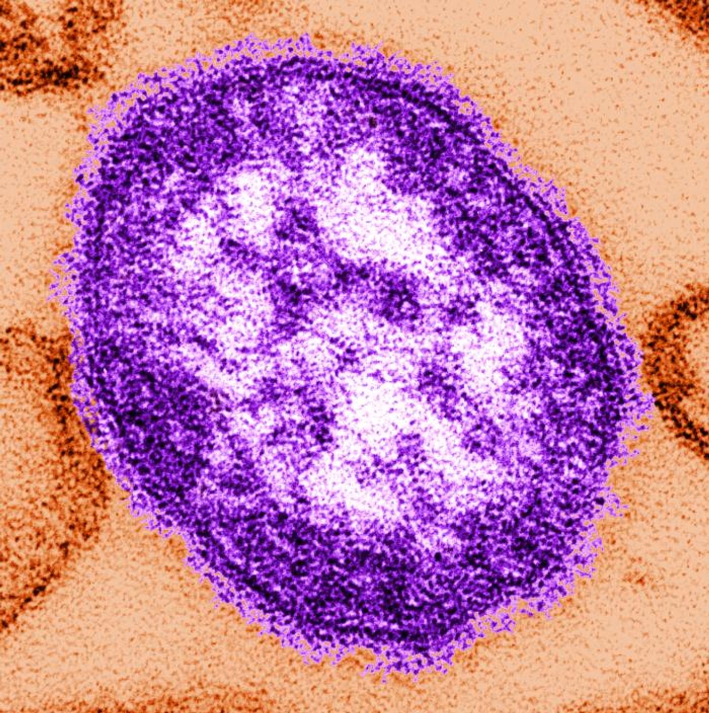 Digitally-colorized, thin-section transmission electron microscopic image of a single measles virus particle, with the viral nucleocapsid situated underneath the viral envelope, surrounded by surface projections. / Credit: CDC/ Cynthia S. Goldsmith; William Bellini, PhD