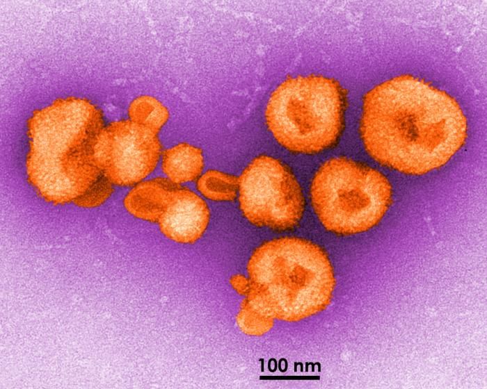 A TEM image of eight virions of a newly-discovered virus, which was determined to be a member of the genus, Arenavirus. This particular virus sickened five South Africans and killed four by causing. / Credit: CDC/ Charles Humphrey