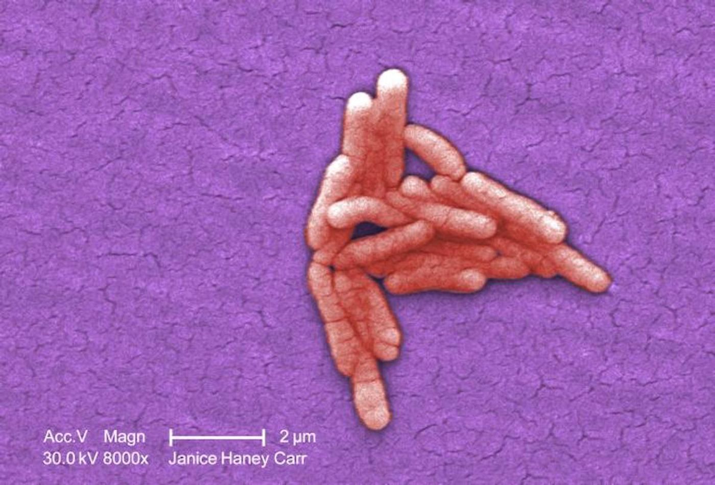 A digitally-colorized SEM image of Salmonella typhimurium bacteria isolated from a pure culture, magnified 8000X. / Credit: CDC/ Bette Jensen