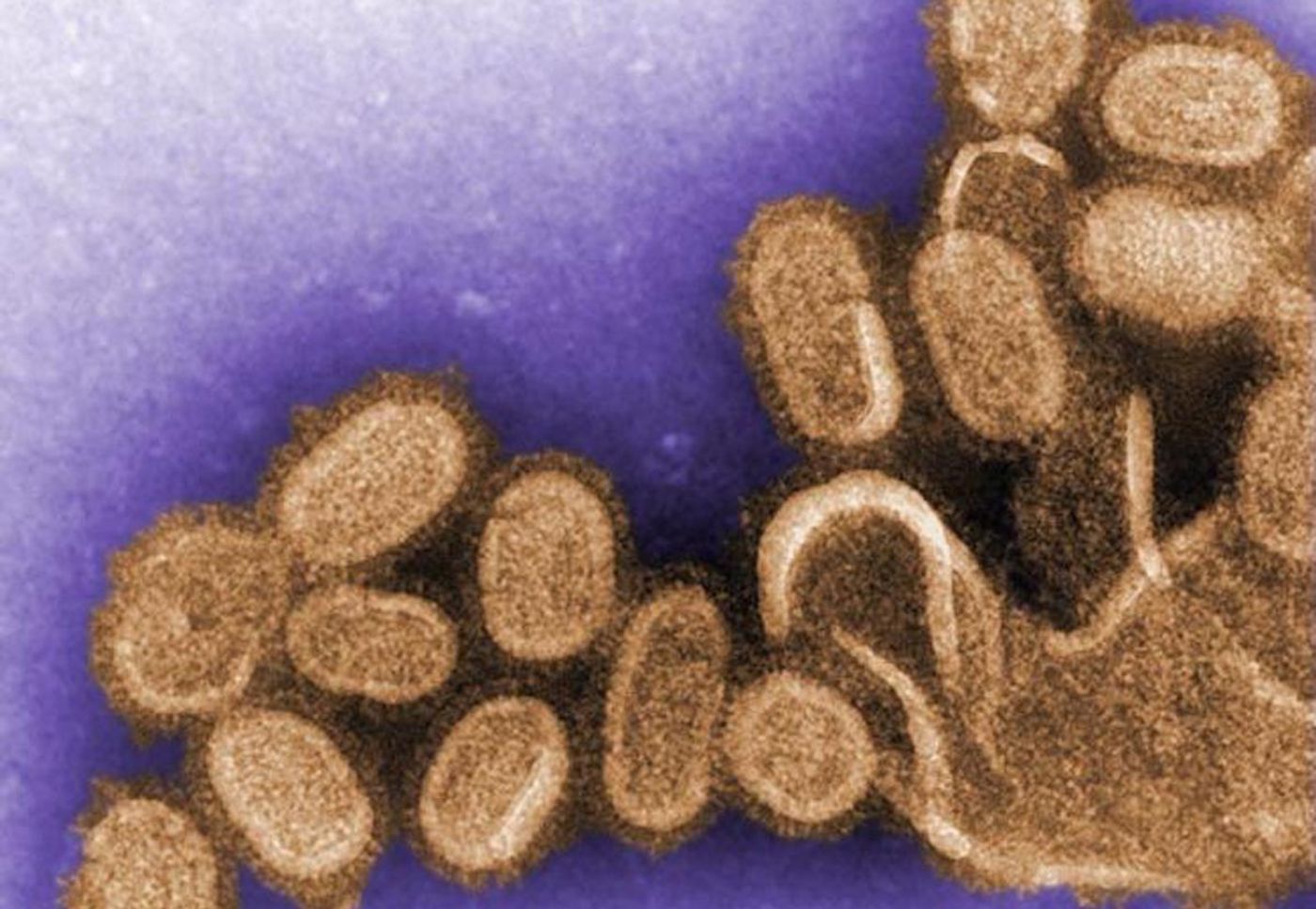 Modified from a digitally-colorized negative-stained transmission electron microscopic (TEM) image shows recreated 1918 influenza virions that were collected from supernatants of 1918-infected Madin-Darby Canine Kidney (MDCK) cells cultures 18 hours after infection. / Credit: CDC/ Dr. Terrence Tumpey