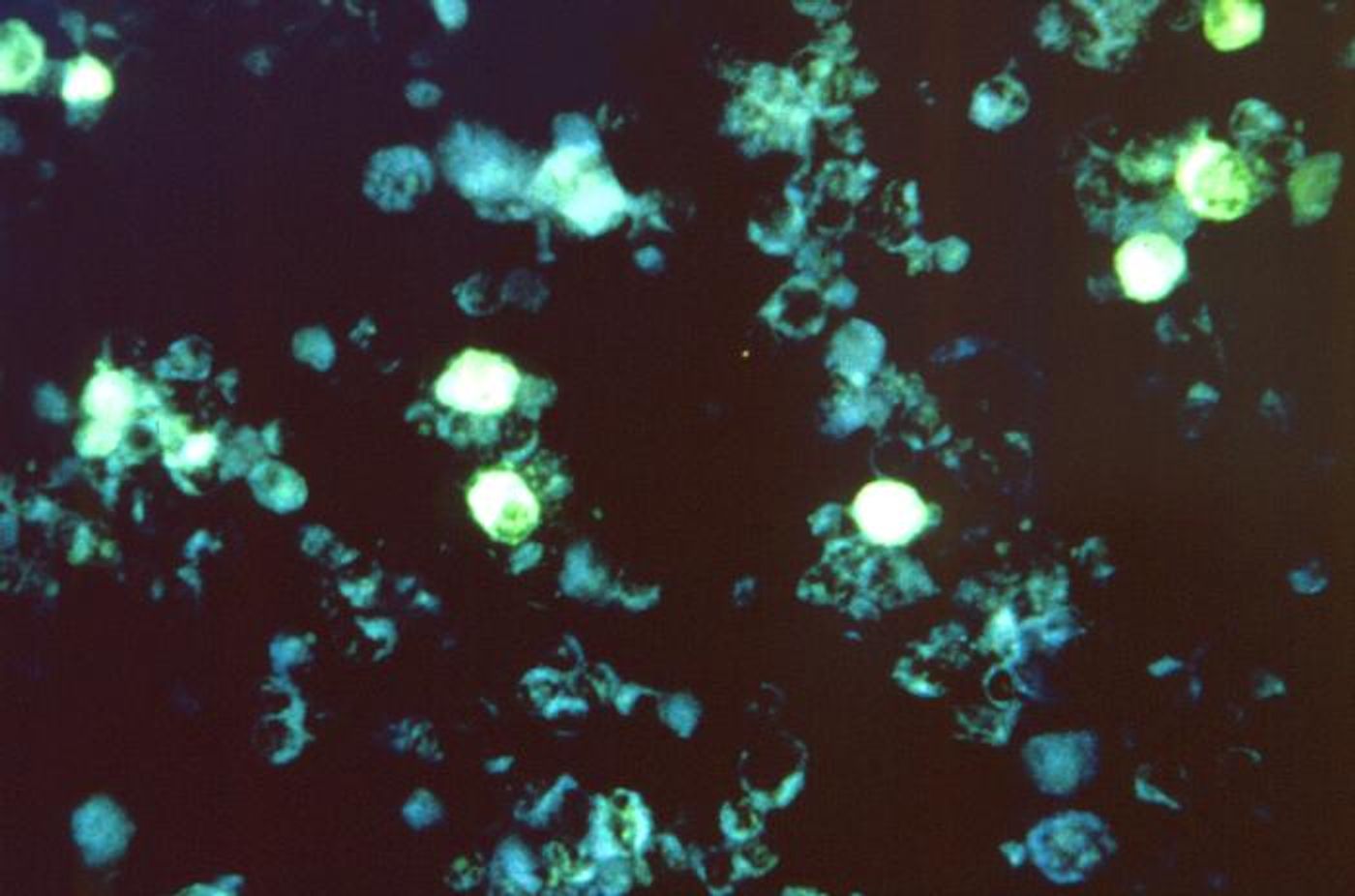 An image of Epstein-Barr virus -infected cell / Credit: CDC/ Dr. P. Feorino 