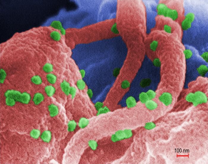 An SEM image showing green, spherical, human immunodeficiency virus (HIV-1), co-cultivated with human lymphocytes / Credit: CDC/ C. Goldsmith, P. Feorino, E. L. Palmer, W. R. McManus