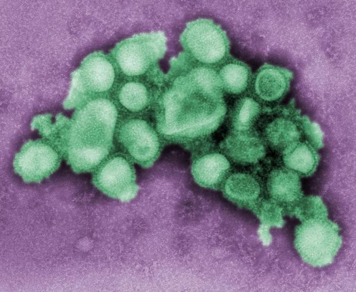 A digitally-colorized TEM image of virions from a 2009 pandemic influenza A (H1N1) virus isolate / Credit: CDC/ C. S. Goldsmith and A. Balish