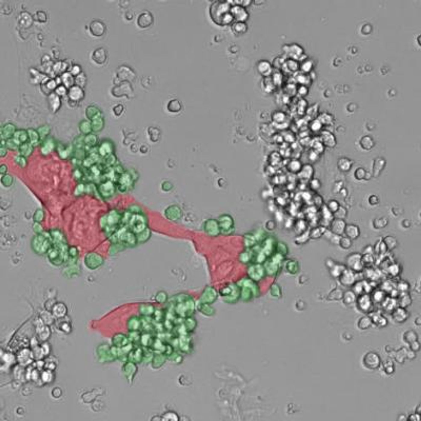 Immune cells (green) attacking tumor cells (red)