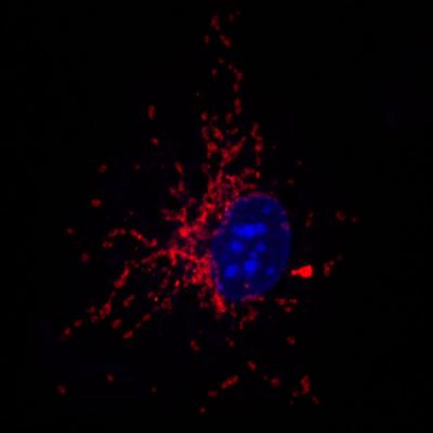 Staining of mitochondria in a macrophage stimulated with bacteria.