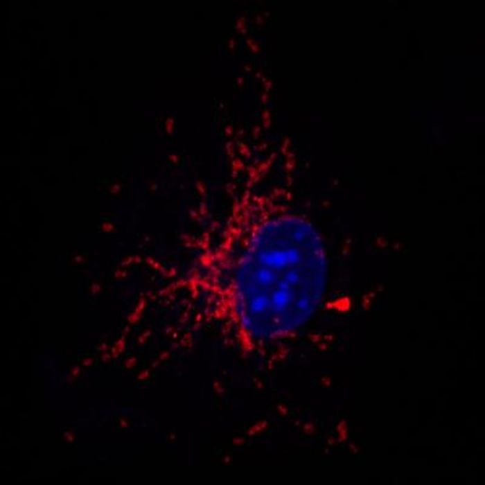 Staining of mitochondria in a macrophage stimulated with bacteria.
