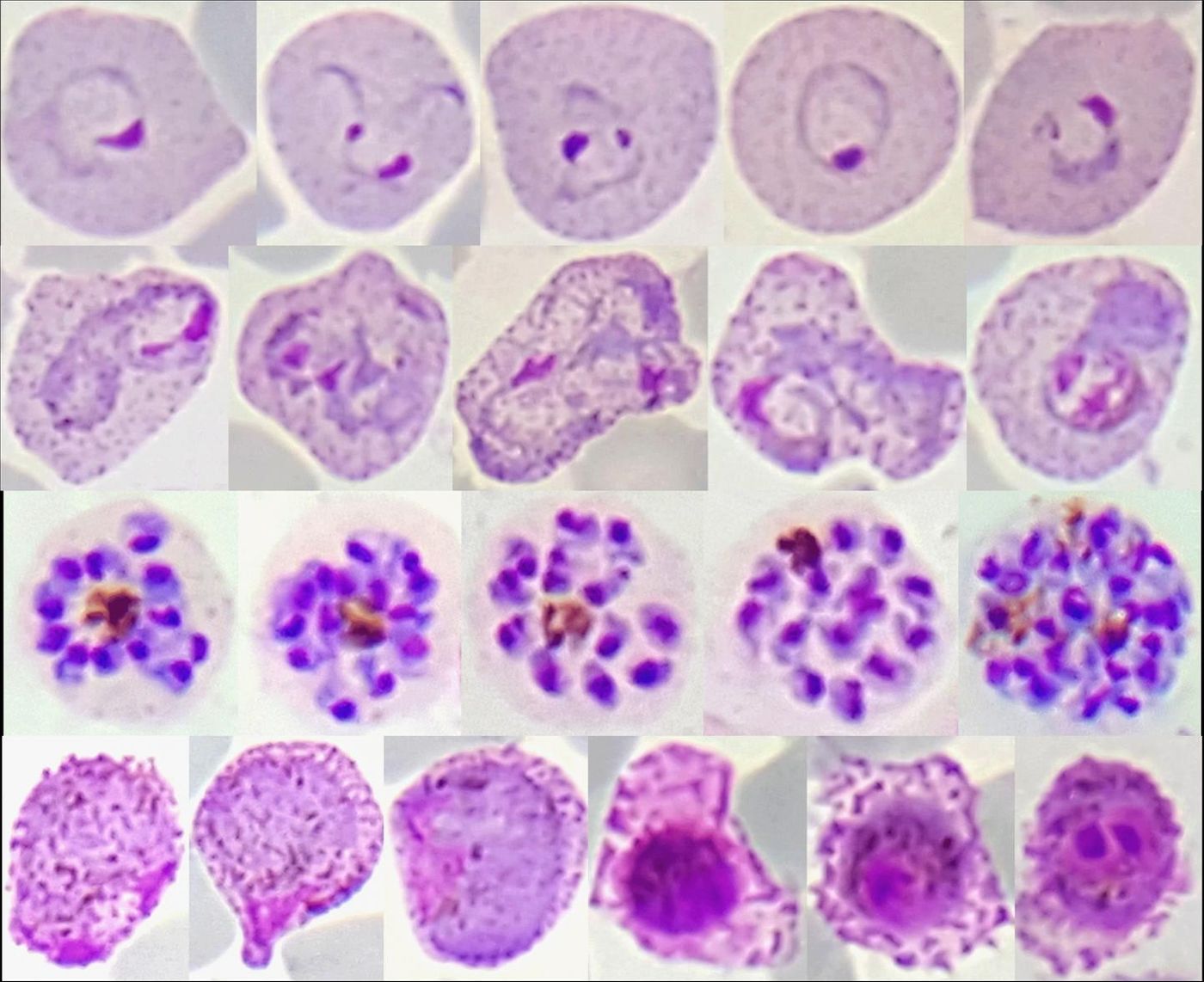 What Are Malaria Parasites Hiding In Their Genes? | Genetics And Genomics