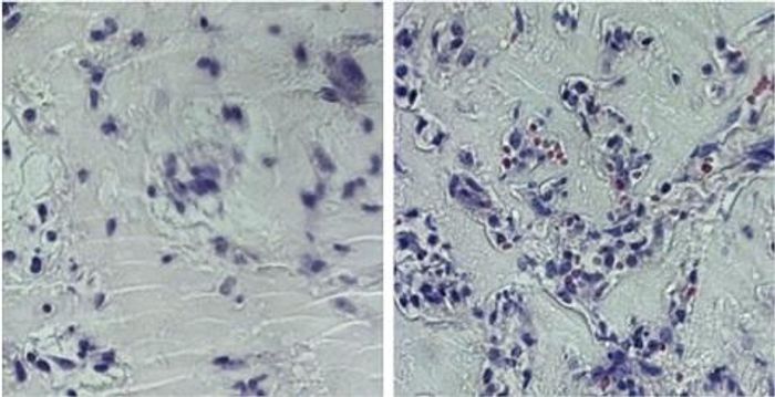 Endothelial cells from growth factors alone (L) VS. growth factors plus glutamine withdrawal (R)