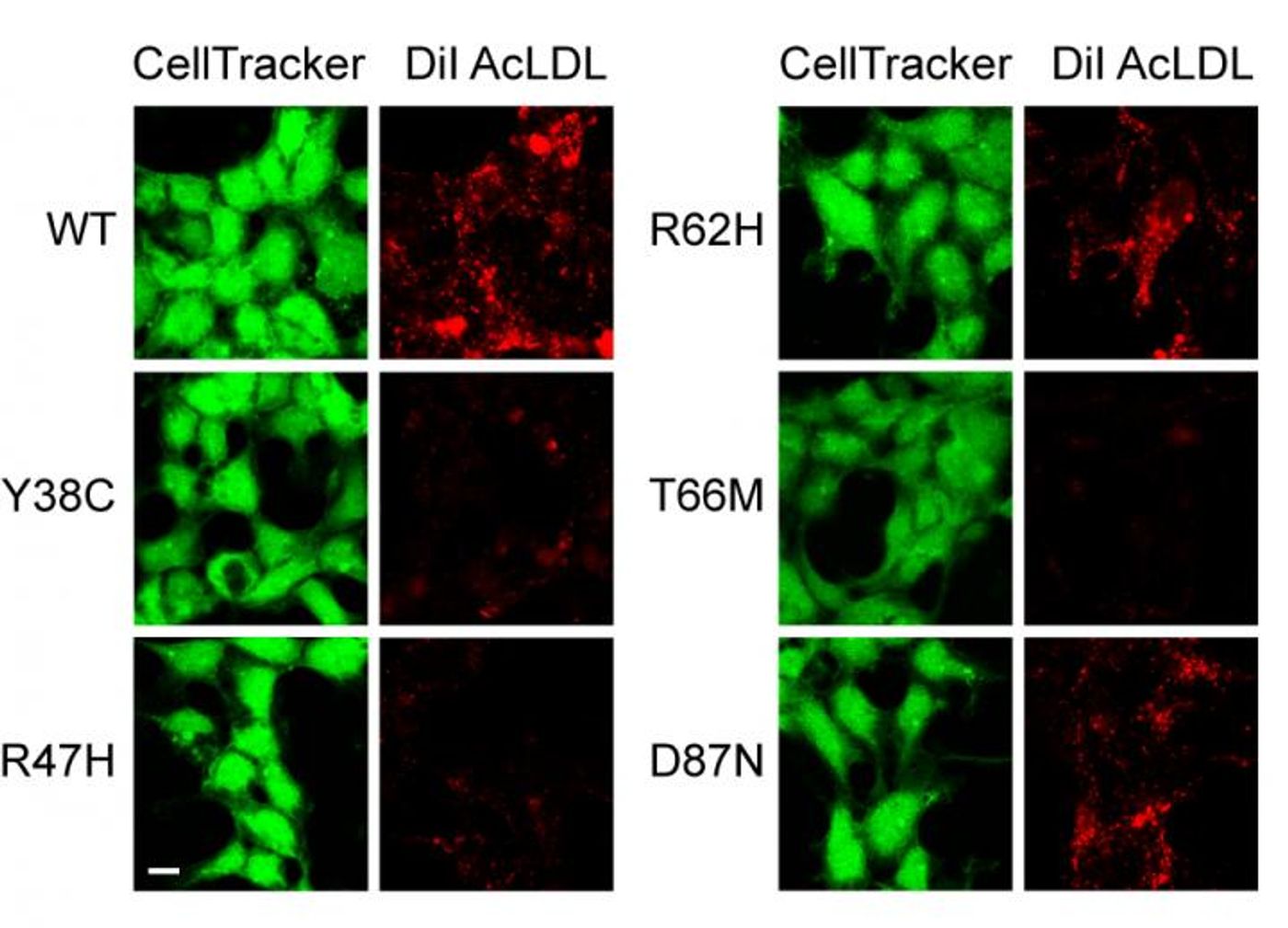 Confocal images of cells (green), and corresponding uptake of lipoproteins (red). Compared to cells with WT TREM2 and mutant TREM2 | Credit: Felix Yeh, PhD, et al.