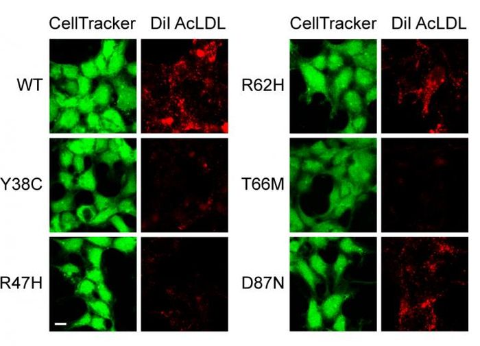 Confocal images of cells (green), and corresponding uptake of lipoproteins (red). Compared to cells with WT TREM2 and mutant TREM2 | Credit: Felix Yeh, PhD, et al.
